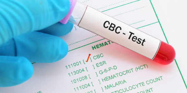 Diabetes Profile