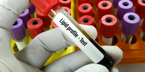 Lipid Profile