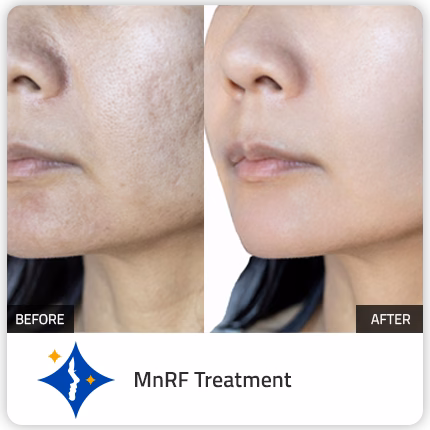 before-after-1