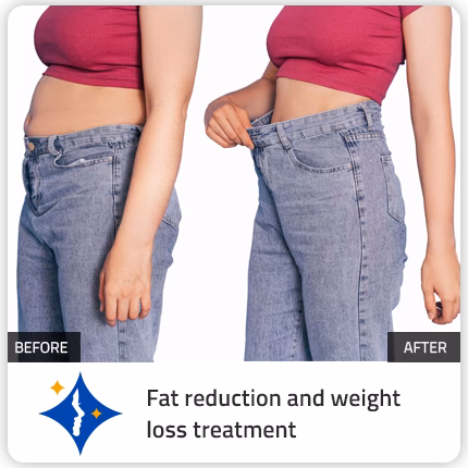 weight loss treatment before after image for fat reduction