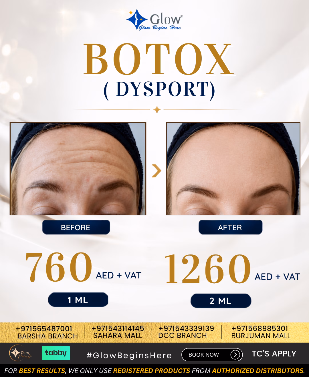 botox dysport 1 ml in offer price in dubai & sharjah